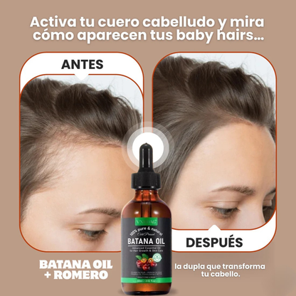 Aceite de Batana + Romero ORIGINAL OFERTA ESPECIAL 🤩